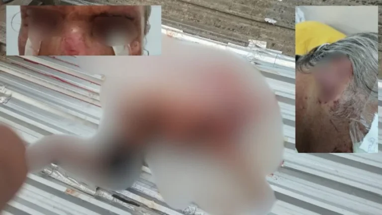 Rejeição à identidade de gênero teria motivado ataque de mulher trans contra idoso em Manaus