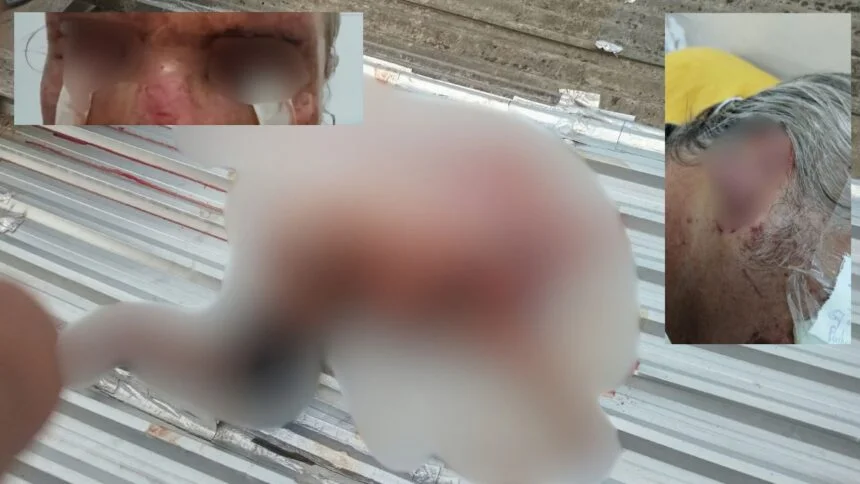 Rejeição à identidade de gênero teria motivado ataque de mulher trans contra idoso em Manaus