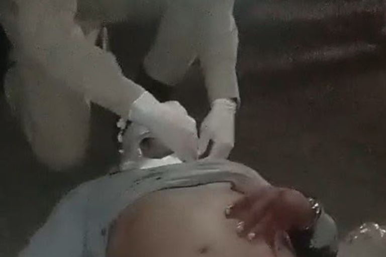 Carro e moto colidem na AM-070 e deixam duas pessoas feridas em Manaus